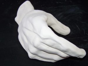 Limp Hand